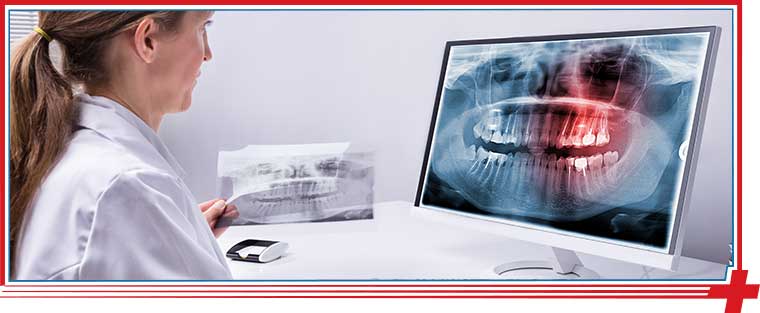 Digital X-Ray Service Near Me in Bulverde Rd San Antonio, Bastrop, Alamo Ranch San Antonio, La Grange, Leon Springs San Antonio, New Braunfels, Potranco Road San Antonio, and Dripping Springs, TX