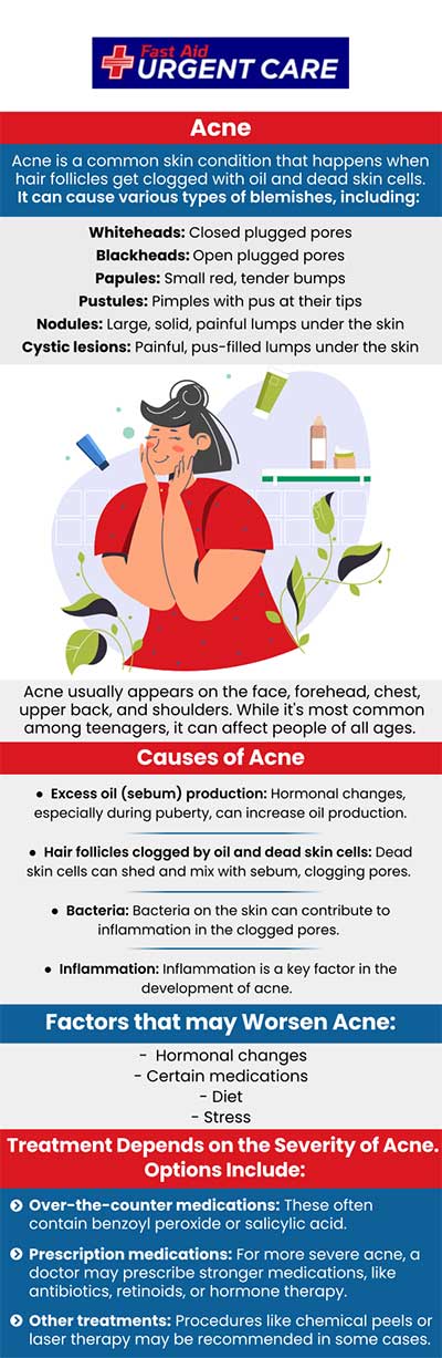 Are you tired of getting acne treatments and still not getting good results? Visit Fast Aid Urgent Care and see our doctors for your acne problems and get comprehensive treatment. For more information, contact us or join the virtual line. We have convenient locations to serve you in Bulverde Rd San Antonio TX, Bastrop TX, Alamo Ranch San Antonio TX, La Grange TX, Leon Springs San Antonio TX, New Braunfels TX, Potranco Road San Antonio TX, Dripping Springs TX, Lemon Creek Boerne TX, and Belle Chasse LA. Are you tired of getting acne treatments and still not getting good results? Visit Fast Aid Urgent Care and see our doctors for your acne problems and get comprehensive treatment. For more information, contact us or join the virtual line. We have convenient locations to serve you in Bulverde Rd San Antonio TX, Bastrop TX, Alamo Ranch San Antonio TX, La Grange TX, Leon Springs San Antonio TX, New Braunfels TX, Potranco Road San Antonio TX, Dripping Springs TX, Lemon Creek Boerne TX, and Belle Chasse LA.