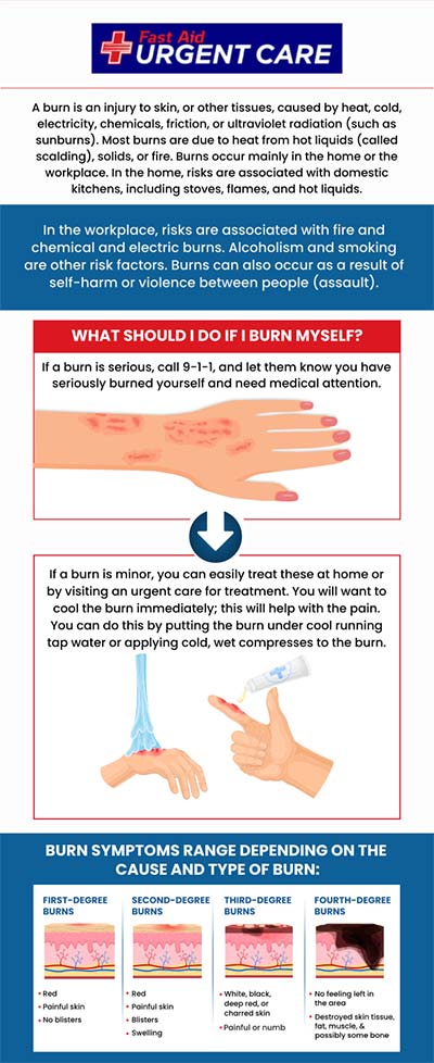 Burns can cause serious injury, damage tissues or muscles, and affect the body. Are you suffering from a burn at home or the workplace? If so, visit our healthcare team right away at Fast Aid Urgent Care. For more information, contact us or join the virtual line. We have convenient locations to serve you in Bulverde Rd San Antonio TX, Bastrop TX, Alamo Ranch San Antonio TX, La Grange TX, Leon Springs San Antonio TX, New Braunfels TX, Potranco Road San Antonio TX, Dripping Springs TX, Lemon Creek Boerne TX, and Belle Chasse LA.