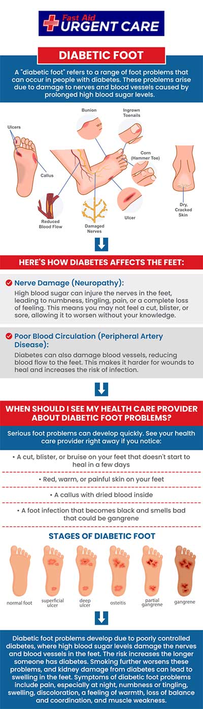 If you suffer from diabetic foot-related issues, our professionals at Fast Aid Urgent Care offer diabetic wound care to help you get relief. You don't need to suffer anymore. Call us today or join the virtual line. We also accept walk-ins. We have convenient locations to serve you in Bulverde Rd San Antonio TX, Bastrop TX, Alamo Ranch San Antonio TX, La Grange TX, Leon Springs San Antonio TX, New Braunfels TX, Potranco Road San Antonio TX, Dripping Springs TX, Lemon Creek Boerne TX, and Belle Chasse LA. If you suffer from diabetic foot-related issues, our professionals at Fast Aid Urgent Care offer diabetic wound care to help you get relief. You don't need to suffer anymore. Call us today or join the virtual line. We also accept walk-ins. We have convenient locations to serve you in Bulverde Rd San Antonio TX, Bastrop TX, Alamo Ranch San Antonio TX, La Grange TX, Leon Springs San Antonio TX, New Braunfels TX, Potranco Road San Antonio TX, Dripping Springs TX, Lemon Creek Boerne TX, and Belle Chasse LA.