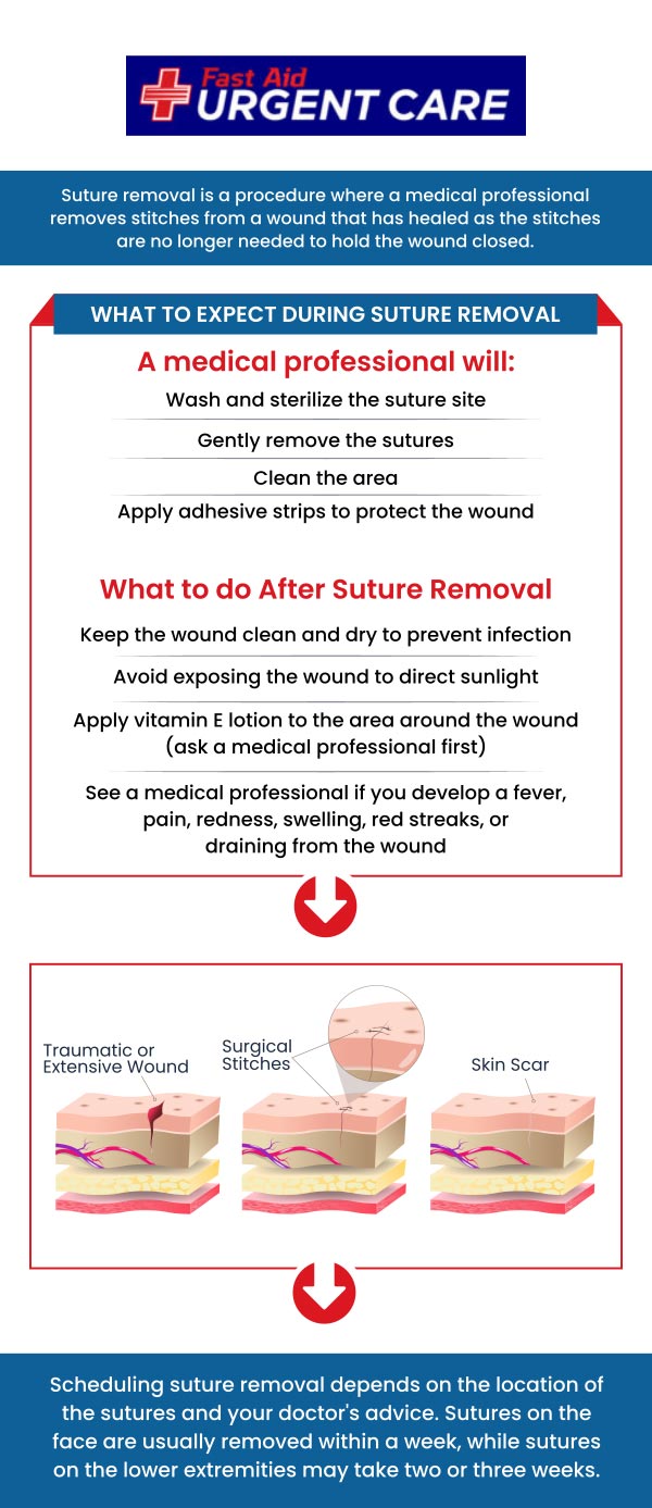 Sutures may also be called stitches, which hold the edges of an open wound, or surgical incision together. They are an important aspect of the healing process, as it help you heal the wound or incision faster. For more information, call Fast Aid Urgent Care or join the virtual line. We have convenient locations to serve you in Bulverde Rd San Antonio TX, Bastrop TX, Alamo Ranch San Antonio TX, La Grange TX, Leon Springs San Antonio TX, New Braunfels TX, Potranco Road San Antonio TX, Dripping Springs TX, Lemon Creek Boerne TX, and Belle Chasse LA. Sutures may also be called stitches, which hold the edges of an open wound, or surgical incision together. They are an important aspect of the healing process, as it help you heal the wound or incision faster. For more information, call Fast Aid Urgent Care or join the virtual line. We have convenient locations to serve you in Bulverde Rd San Antonio TX, Bastrop TX, Alamo Ranch San Antonio TX, La Grange TX, Leon Springs San Antonio TX, New Braunfels TX, Potranco Road San Antonio TX, Dripping Springs TX, Lemon Creek Boerne TX, and Belle Chasse LA.