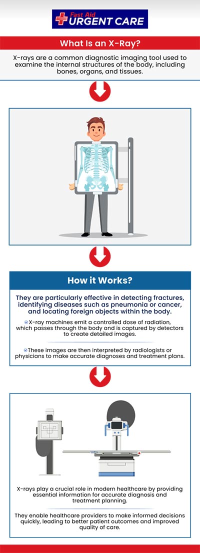 Trust Fast Aid Urgent Care for your next digital x-ray. Our doctors are here to provide you with the best possible service and are dedicated to ensuring you receive the right treatment for your medical issue. Call our office to speak with one of our specialists, or join the virtual line. We have convenient locations to serve you in Bulverde Rd San Antonio TX, Bastrop TX, Alamo Ranch San Antonio TX, La Grange TX, Leon Springs San Antonio TX, New Braunfels TX, Potranco Road San Antonio TX, Dripping Springs TX, Lemon Creek Boerne TX, and Belle Chasse LA. Trust Fast Aid Urgent Care for your next digital x-ray. Our doctors are here to provide you with the best possible service and are dedicated to ensuring you receive the right treatment for your medical issue. Call our office to speak with one of our specialists, or join the virtual line. We have convenient locations to serve you in Bulverde Rd San Antonio TX, Bastrop TX, Alamo Ranch San Antonio TX, La Grange TX, Leon Springs San Antonio TX, New Braunfels TX, Potranco Road San Antonio TX, Dripping Springs TX, Lemon Creek Boerne TX, and Belle Chasse LA.
