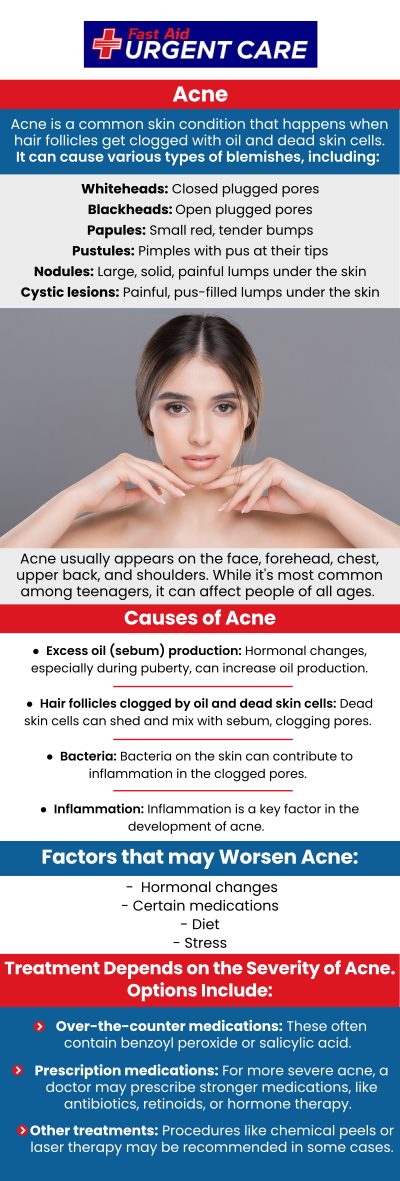 Treating an infected pimple requires a careful approach to avoid further irritation or infection. Over-the-counter treatments with benzoyl peroxide or salicylic acid can help reduce inflammation and bacteria. Dr. Curtis Grote, MD, at Fast Aid Urgent Care, advises against squeezing or picking at the pimple, as this can worsen the infection and lead to scarring. For more information, contact us or join the virtual line. We have convenient locations to serve you in Bulverde Rd San Antonio TX, Bastrop TX, Alamo Ranch San Antonio TX, La Grange TX, Leon Springs San Antonio TX, New Braunfels TX, Potranco Road San Antonio TX, Dripping Springs TX, Lemon Creek Boerne TX, and Belle Chasse LA.